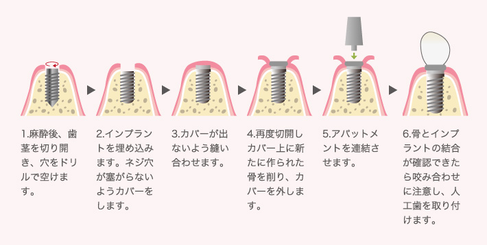 2回法の場合